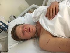 Наушники Apple едва не обезглавили 16-летнего байкера в Австралии