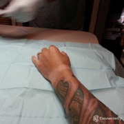 Американец имплантировал в руку чип NFC для разблокировки смартфона