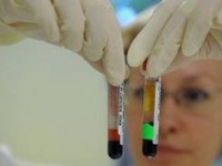 От последствий H1N1 избавит генетическая терапия