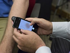Смартфоны помогут в диагностике рака кожи