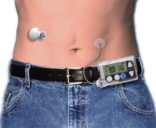 Ваш кардиостимулятор тоже могут «хакнуть»