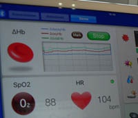 С датчиками Alps компьютерные мышки смогут определять эмоциональный стресс