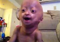 Шестилетняя девочка-старушка стала звездой интернета