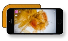 Миниатюрное устройство превращает любой смартфон в мощный микроскоп