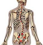 Опасайтесь остеохондроза, если работаете за компьютером