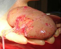 Китайцы продавали свои почки, чтобы купить смартфон