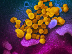 В игре Plague Inc появится возможность спасти мир от пандемии