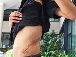 Молодой человек отдал почку за iPhone и остался инвалидом