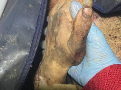 "Вічно триматиму тебе за руку": мережу розчулило фото дівчини із загиблим на війні коханим