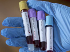 У МОЗ назвали офіційні джерела, з яких можна дізнатись актуальну інформацію про коронавірус