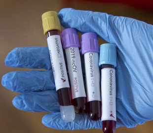 У МОЗ назвали офіційні джерела, з яких можна дізнатись актуальну інформацію про коронавірус