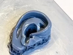 Ученые напечатали на 3D-принтере человеческое ухо