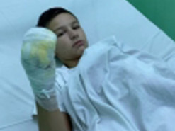 Бердянский подросток, которого подожгли ради видео в сети, рассказал подробности инцидента