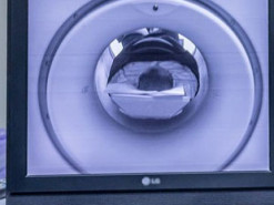 Не хуже врачей: ИИ научили ставить диагнозы по МРТ