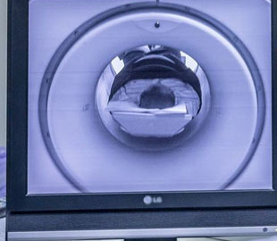 Не хуже врачей: ИИ научили ставить диагнозы по МРТ