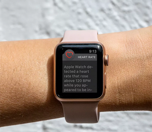 Apple вызвали в суд за незаконное использование технологии измерения ЧСС в Apple Watch