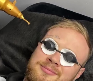 Харьковский блогер убрал со лба татуировку «Кернес жив»