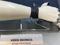 З NFC, Bluetooth та ШІ: як український робо-протез замінить людям справжні руки