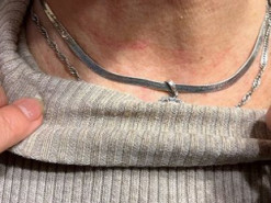 У столичному хостелі через гроші намагалися задушити переселенку