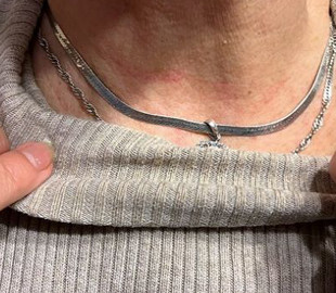 У столичному хостелі через гроші намагалися задушити переселенку