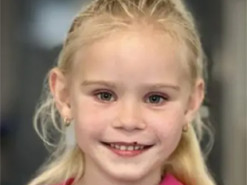 Львівський робот-хірург врятував 6-річну дівчинку з рідкісним синдромом