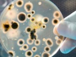 «Може призвести до смерті»: лікарі розповіли, чим небезпечна сибірка, яку нещодавно виявили на Київщині