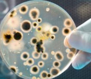 «Може призвести до смерті»: лікарі розповіли, чим небезпечна сибірка, яку нещодавно виявили на Київщині