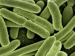 Інформацію про захворювання на холеру в Києві спростовують