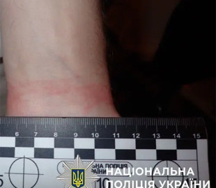Жертва онлайн-знайомства: киянина побили і пограбували у власній квартирі