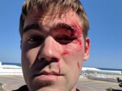 В Киеве владелец известного интернет-магазина избил клиента