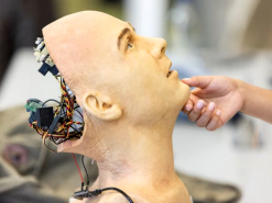 У першому імплантаті мозку людини Neuralink виникла проблема