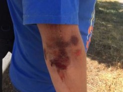 Избили редактора херсонского интернет издания