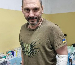 “В Чернігів ми так і не потрапили”. Журналіст 1+1 отримав осколкове поранення дорогою в місто