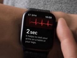Apple снизила риск осложнения сердечных заболеваний у 400 000 человек
