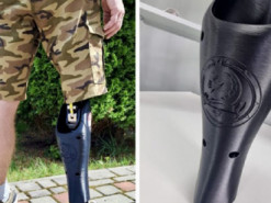 Подружжя медиків з Тернополя започаткували проєкт 3D-друку безплатних персоналізованих накладок на протези для військових