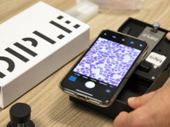 Создан микроскоп для смартфона с 1000-кратным зумом