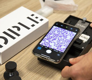 Создан микроскоп для смартфона с 1000-кратным зумом