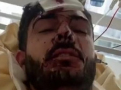 Во Франции совершено покушение на азербайджанского блогера, критикующего Алиева