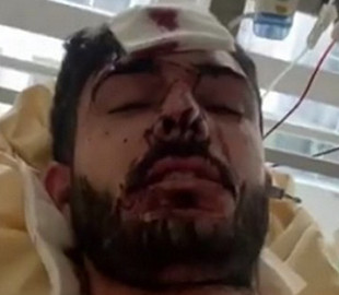 Во Франции совершено покушение на азербайджанского блогера, критикующего Алиева