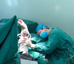 Фото хирурга, уснувшего за операционным столом, стало вирусным в Сети