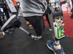 Совершенствование алгоритмов ИИ приведет к революции в протезировании