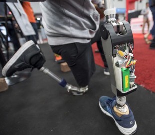 Совершенствование алгоритмов ИИ приведет к революции в протезировании