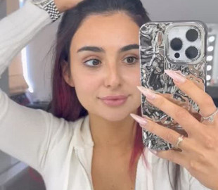 Анна Трінчер з розпухлим обличчям дала перший після операції концерт у Києві