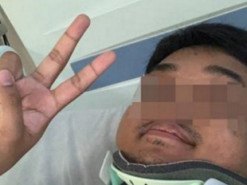 Apple Watch самостоятельно вызвали скорую сбитому мотоциклисту и связались с его девушкой