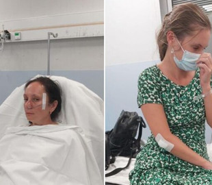 Росіяни у Франції жорстоко побили біженок із України: подробиці