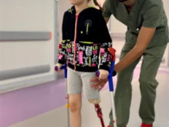 6-річна дівчинка з Херсонщини, яка втратила ногу через ракетний удар РФ, зробила перші кроки на протезі. Фото