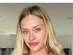 Травмована в Дубаї українська модель OnlyFans прийшла до тями: що з нею зараз