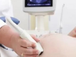 Ефросинина и Осадчая эмоционально отреагировали на петицию о запрете абортов в Украине