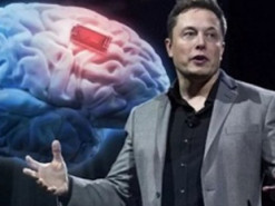 Илон Маск раскрыл некоторые подробности о мозговом импланте Neuralink