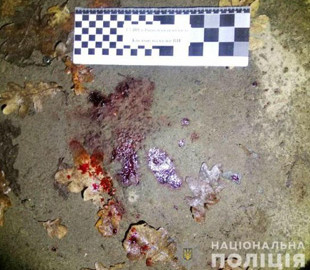 Чоловік ледь не забив до смерті іншого за позичену музичну колонку